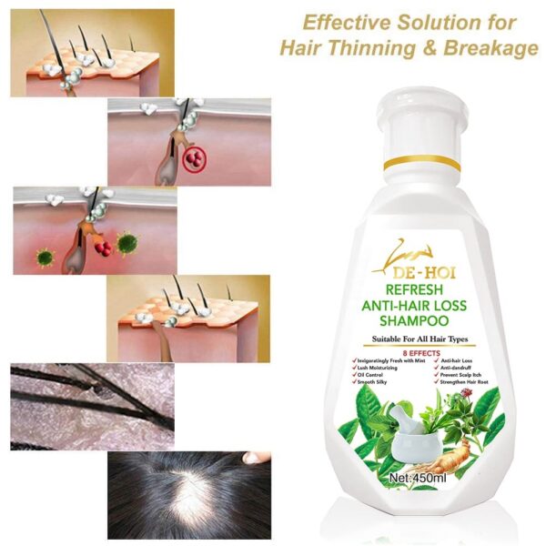 De-Hoi  Refresh Anti-hair Loss Shampoo Ginger Hair Care Shampoo Helps Stop Hair Loss 450ml - Image 6