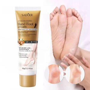 SADOER Hand Foot Cream - 60gram Hand Foot Cream Moisturizing Calluses Dead Skin Repair Rehydration Soften Cuticle Smooth Restore Feet Care Products