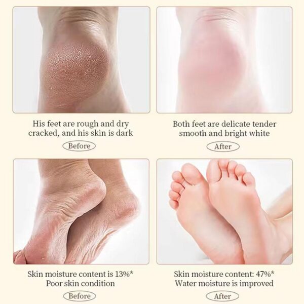 SADOER Hand Foot Cream - 60gram Hand Foot Cream Moisturizing Calluses Dead Skin Repair Rehydration Soften Cuticle Smooth Restore Feet Care Products - Image 5