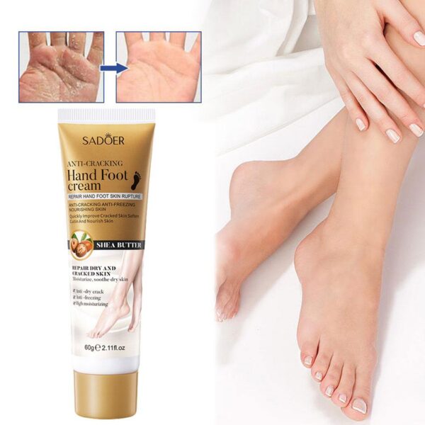 SADOER Hand Foot Cream - 60gram Hand Foot Cream Moisturizing Calluses Dead Skin Repair Rehydration Soften Cuticle Smooth Restore Feet Care Products - Image 3